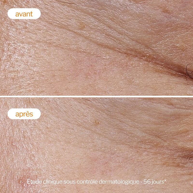 Novexpert Crème Légère à la Vitamine C
