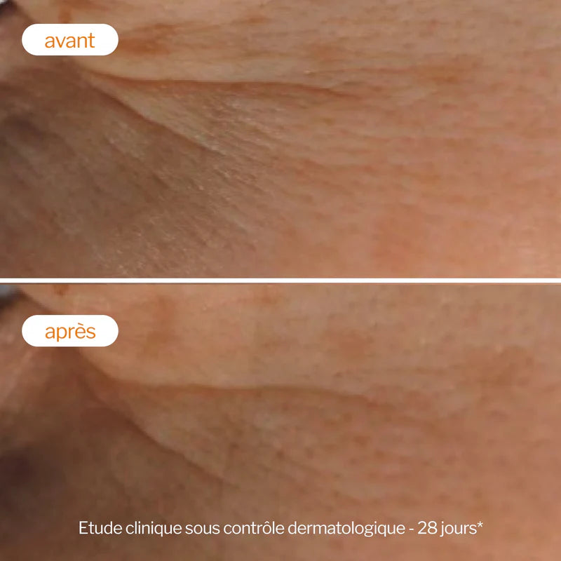 Novexpert Soin Peeling Éclat Vitamine C 30ml