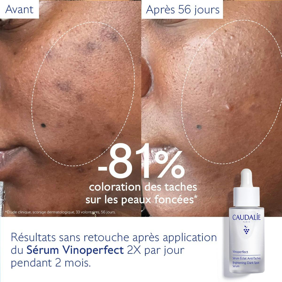 CAUDALIE VINOPERFECT Sérum Éclat Anti-Taches 30ml