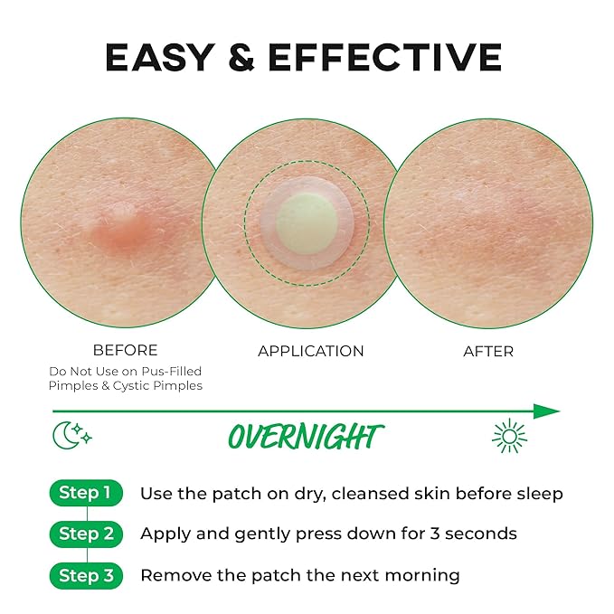 Nolahour – Spot Eraser Step 1
