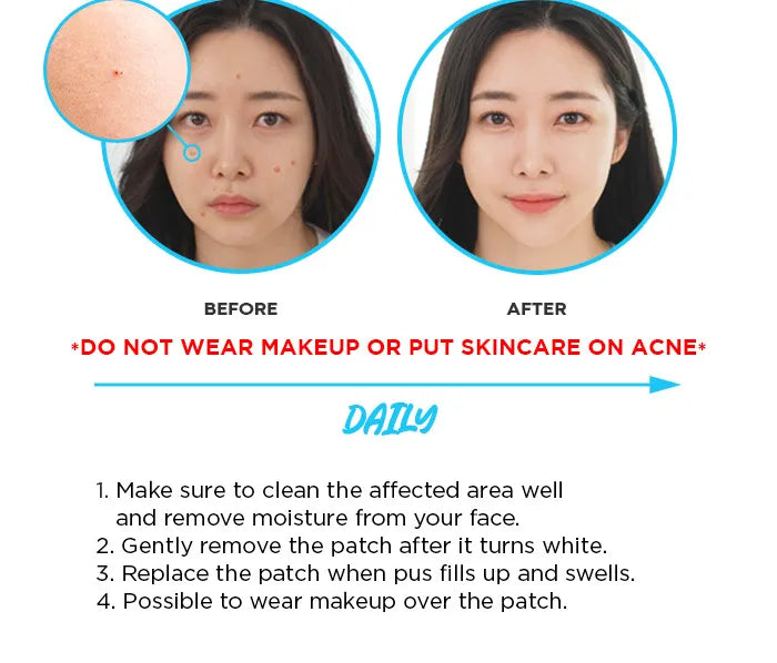 Nolahour – Spot Eraser Step 2