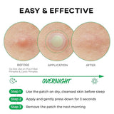 Nolahour – Spot Eraser Step 1