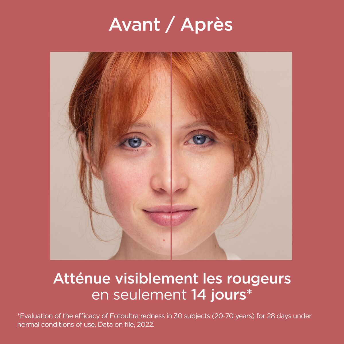 ISDIN Fotoultra Redness SPF 50+